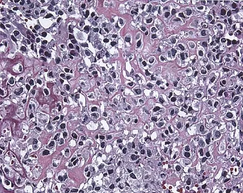 Mtd 2026 MCQs: Board Review Questions & Answers (Part 2) - Figure 61