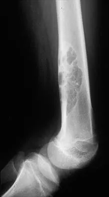 Mtd 2026 MCQs: Board Review Questions & Answers (Part 2) - Figure 71