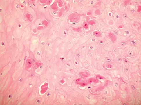 Mtd 2026 MCQs: Board Review Questions & Answers (Part 3) - Figure 103