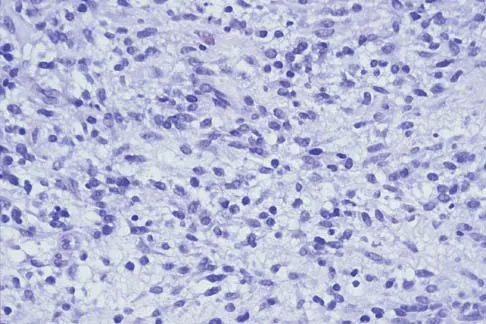 Mtd 2026 MCQs: Board Review Questions & Answers (Part 3) - Figure 107