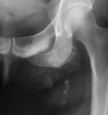 Mtd 2026 MCQs: Board Review Questions & Answers (Part 3) - Figure 109