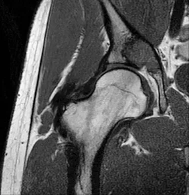 Mtd 2026 MCQs: Board Review Questions & Answers (Part 3) - Figure 139