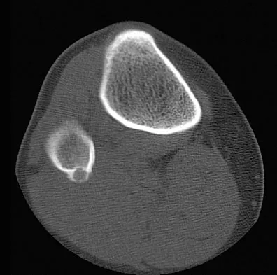 Mtd 2026 MCQs: Board Review Questions & Answers (Part 3) - Figure 147