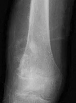 Mtd 2026 MCQs: Board Review Questions & Answers (Part 3) - Figure 155