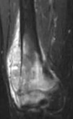 Mtd 2026 MCQs: Board Review Questions & Answers (Part 3) - Figure 159