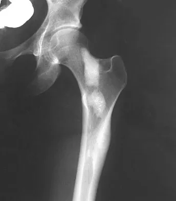 Mtd 2026 MCQs: Board Review Questions & Answers (Part 3) - Figure 173