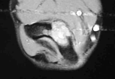 Mtd 2026 MCQs: Board Review Questions & Answers (Part 3) - Figure 185