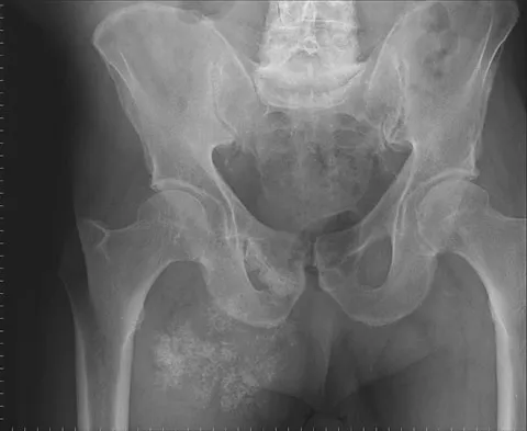 Mtd 2026 MCQs: Board Review Questions & Answers (Part 3) - Figure 213