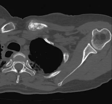 Mtd 2026 MCQs: Board Review Questions & Answers (Part 3) - Figure 221