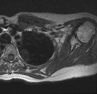 Mtd 2026 MCQs: Board Review Questions & Answers (Part 3) - Figure 223