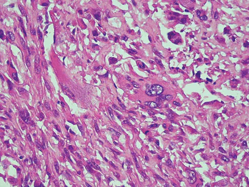 Mtd 2026 MCQs: Board Review Questions & Answers (Part 3) - Figure 225