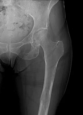 Mtd 2026 MCQs: Board Review Questions & Answers (Part 3) - Figure 235