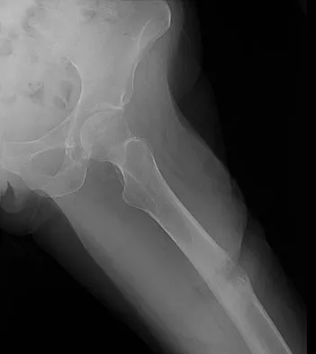 Mtd 2026 MCQs: Board Review Questions & Answers (Part 3) - Figure 237