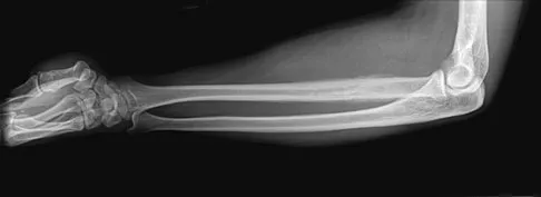 Mtd 2026 MCQs: Board Review Questions & Answers (Part 3) - Figure 241