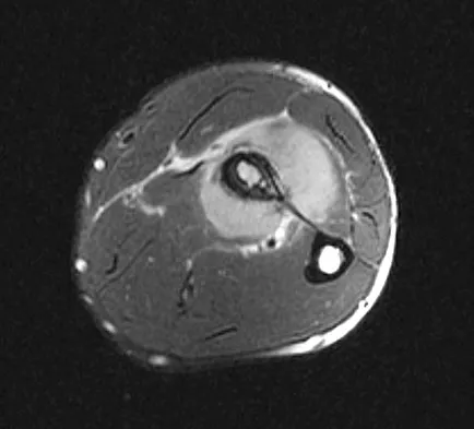 Mtd 2026 MCQs: Board Review Questions & Answers (Part 3) - Figure 247