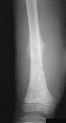 Mtd 2026 MCQs: Board Review Questions & Answers (Part 3) - Figure 257