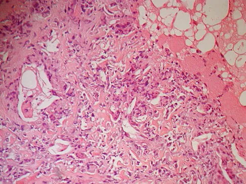 Mtd 2026 MCQs: Board Review Questions & Answers (Part 3) - Figure 261