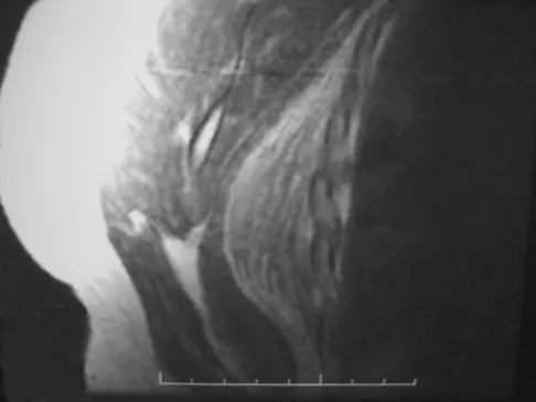 Mtd 2026 MCQs: Board Review Questions & Answers (Part 3) - Figure 267