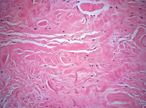 Mtd 2026 MCQs: Board Review Questions & Answers (Part 3) - Figure 269