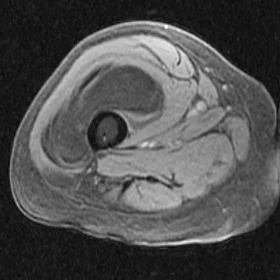 Mtd 2026 MCQs: Board Review Questions & Answers (Part 3) - Figure 275