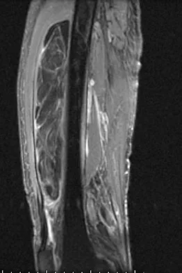 Mtd 2026 MCQs: Board Review Questions & Answers (Part 3) - Figure 277