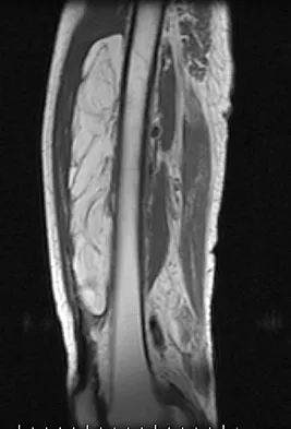 Mtd 2026 MCQs: Board Review Questions & Answers (Part 3) - Figure 279