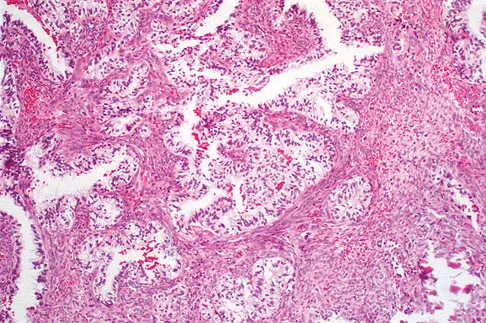 Mtd 2026 MCQs: Board Review Questions & Answers (Part 3) - Figure 283