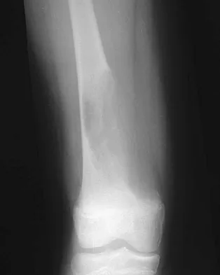 Mtd 2026 MCQs: Board Review Questions & Answers (Part 3) - Figure 303