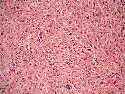 Mtd 2026 MCQs: Board Review Questions & Answers (Part 3) - Figure 307