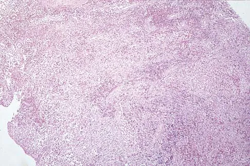 Mtd 2026 MCQs: Board Review Questions & Answers (Part 3) - Figure 43