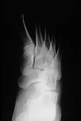 Mtd 2026 MCQs: Board Review Questions & Answers (Part 3) - Figure 51