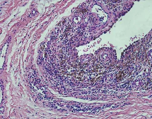 Mtd 2026 MCQs: Board Review Questions & Answers (Part 3) - Figure 57
