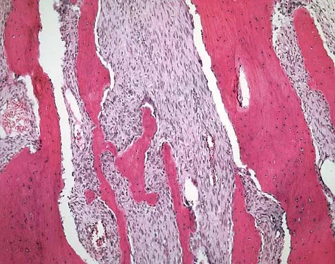 Mtd 2026 MCQs: Board Review Questions & Answers (Part 3) - Figure 67