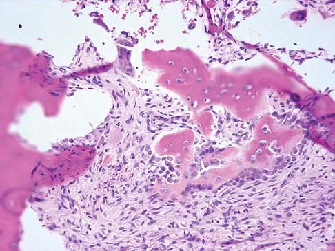 Mtd 2026 MCQs: Board Review Questions & Answers (Part 3) - Figure 79