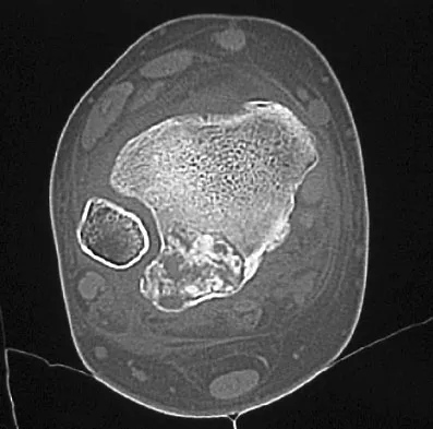 Mtd 2026 MCQs: Board Review Questions & Answers (Part 4) - Figure 119