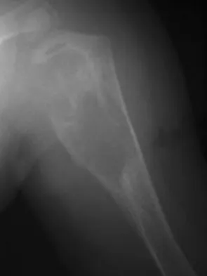 Mtd 2026 MCQs: Board Review Questions & Answers (Part 4) - Figure 129