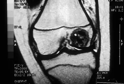 Mtd 2026 MCQs: Board Review Questions & Answers (Part 4) - Figure 13