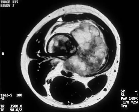 Mtd 2026 MCQs: Board Review Questions & Answers (Part 4) - Figure 27