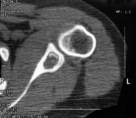 Mtd 2026 MCQs: Board Review Questions & Answers (Part 4) - Figure 51