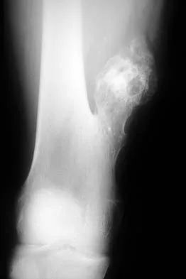 Mtd 2026 MCQs: Board Review Questions & Answers (Part 4) - Figure 65