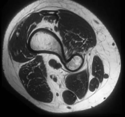 Mtd 2026 MCQs: Board Review Questions & Answers (Part 4) - Figure 67