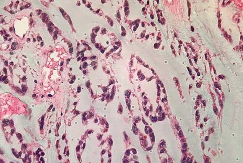 Mtd 2026 MCQs: Board Review Questions & Answers (Part 4) - Figure 69