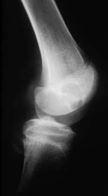 Mtd 2026 MCQs: Board Review Questions & Answers (Part 4) - Figure 7