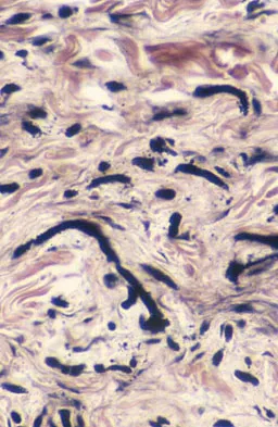 Mtd 2026 MCQs: Board Review Questions & Answers (Part 4) - Figure 93