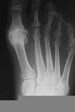 Orthopedic Foot & Ankle 2026 MCQs: Board Review Questions & Answers (Part 1) Figure 2