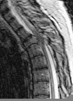 Orthopedic Spine 2026 MCQs: Board Review Questions & Answers (Part 3) Figure 3