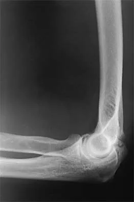 Orthopedic Surgery Board Review 2026 | High-Yield MCQs - Set 1 - Figure 1