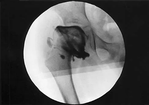 Orthopedic Surgery Board Review 2026 | High-Yield MCQs - Set 1 - Figure 13