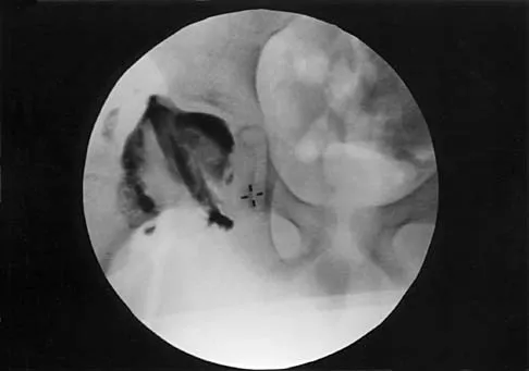 Orthopedic Surgery Board Review 2026 | High-Yield MCQs - Set 1 - Figure 14