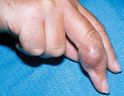 Orthopedic Surgery Board Review 2026 | High-Yield MCQs - Set 1 - Figure 22